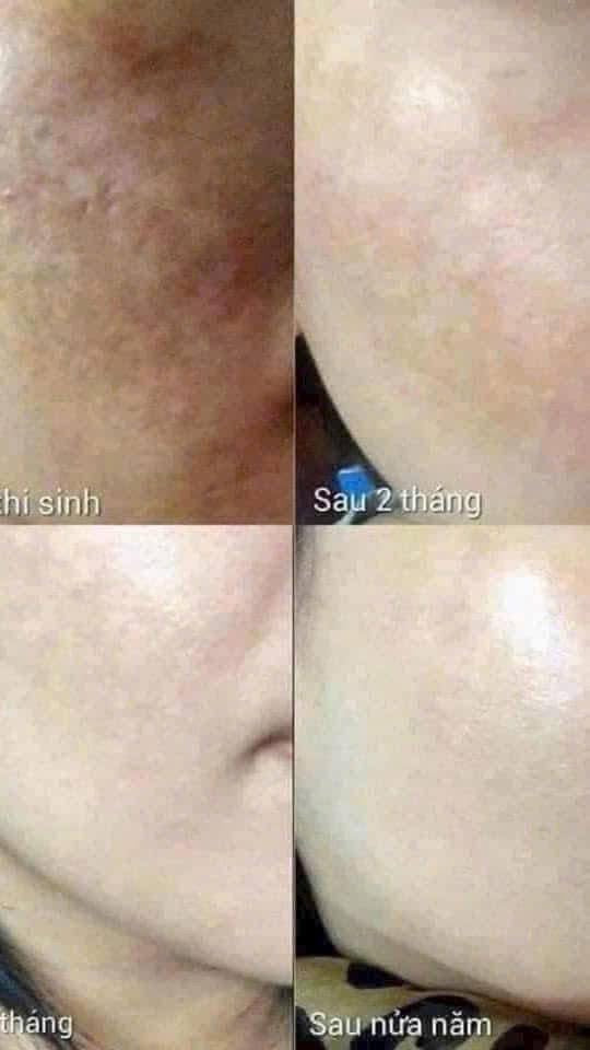 THE WHOO WHITE RADIANT MOISTURE FULL SET OF 8 ITEMS