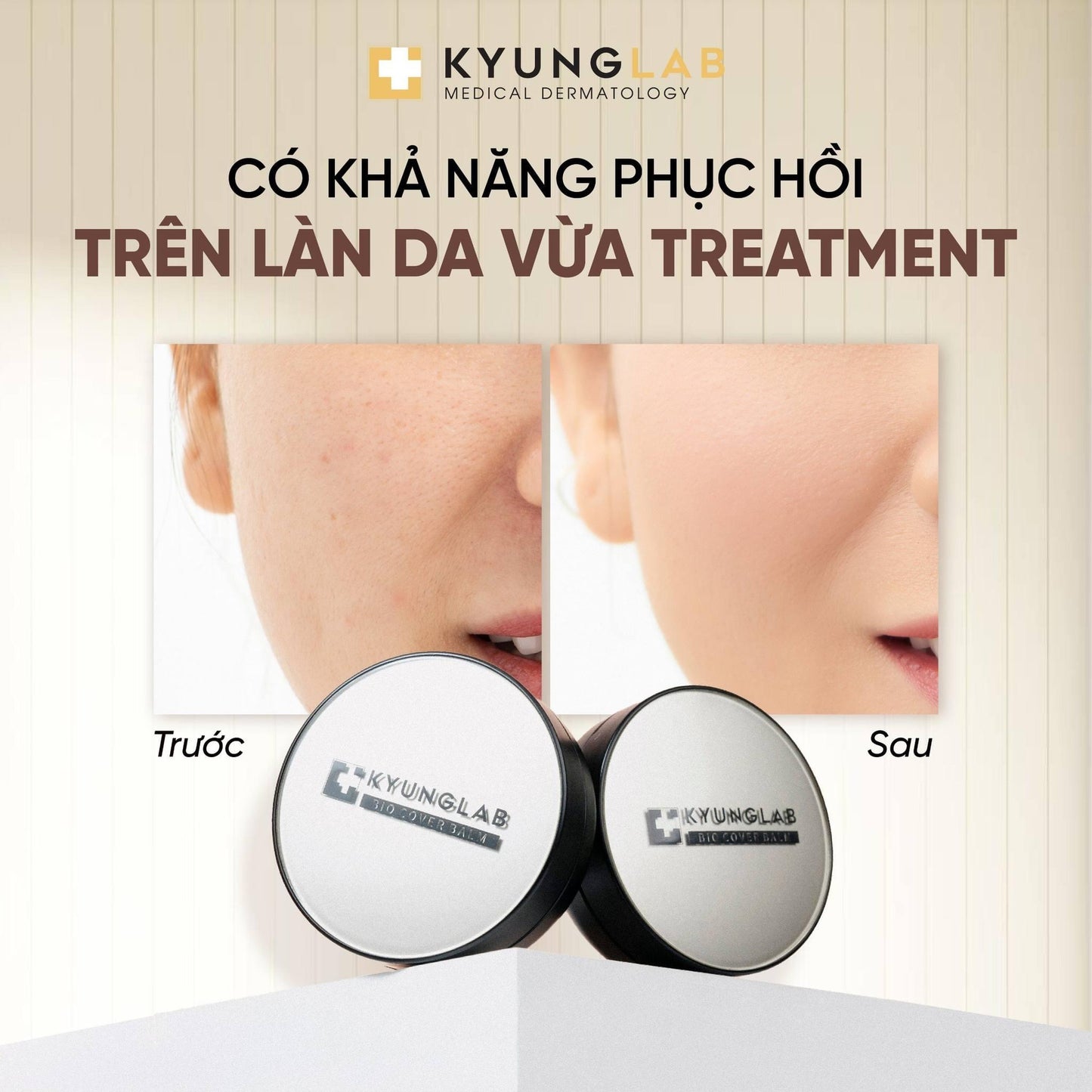 KYUNG LAB BIO COVER BALM CUSHION #21 NATURAL 15G POST TREATMENTS CUSHION