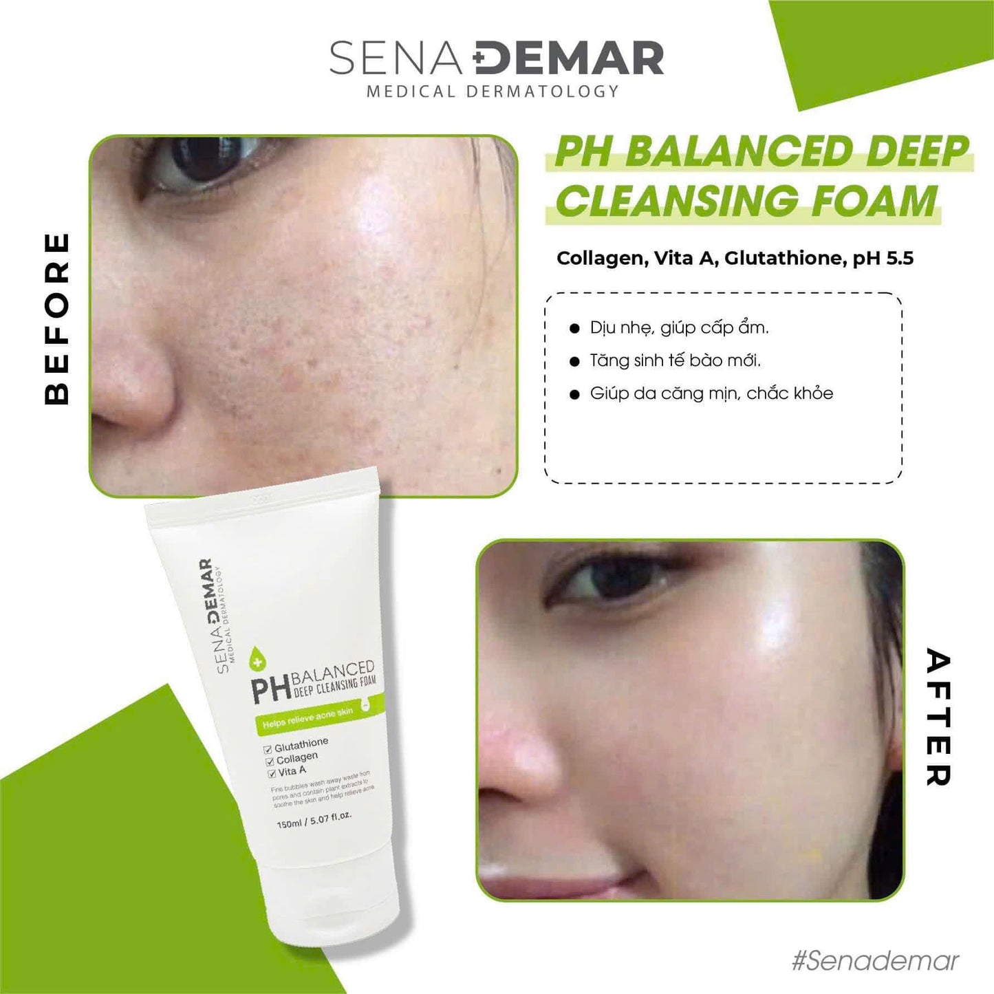 SENADERMA pH BALANCE DEEP CLEANSING FOAM 150ML