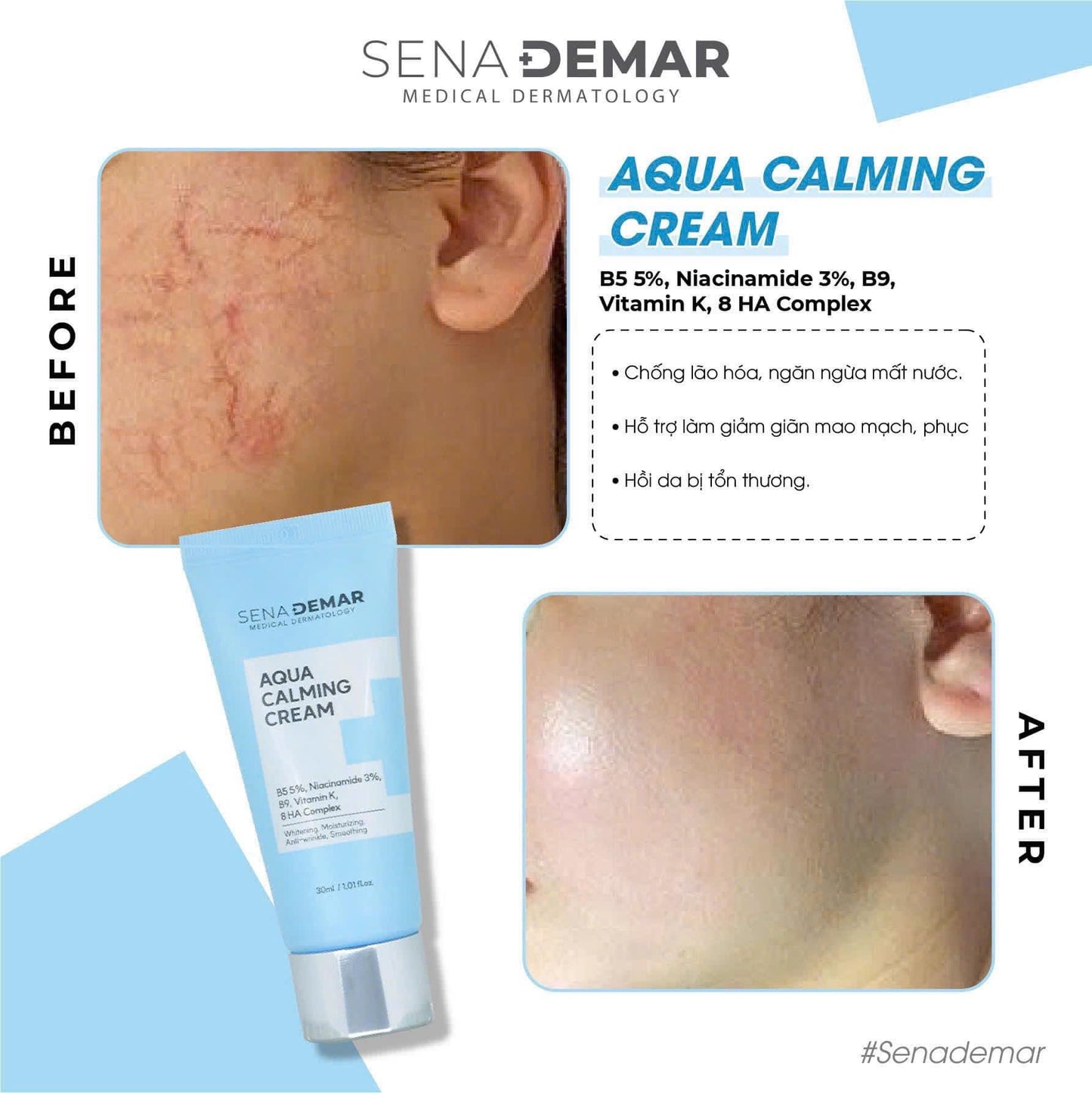 SENADERMA WHITENING DAY CREAM 30ML & AQUA CALMING CREAM 30ML BUNDLE