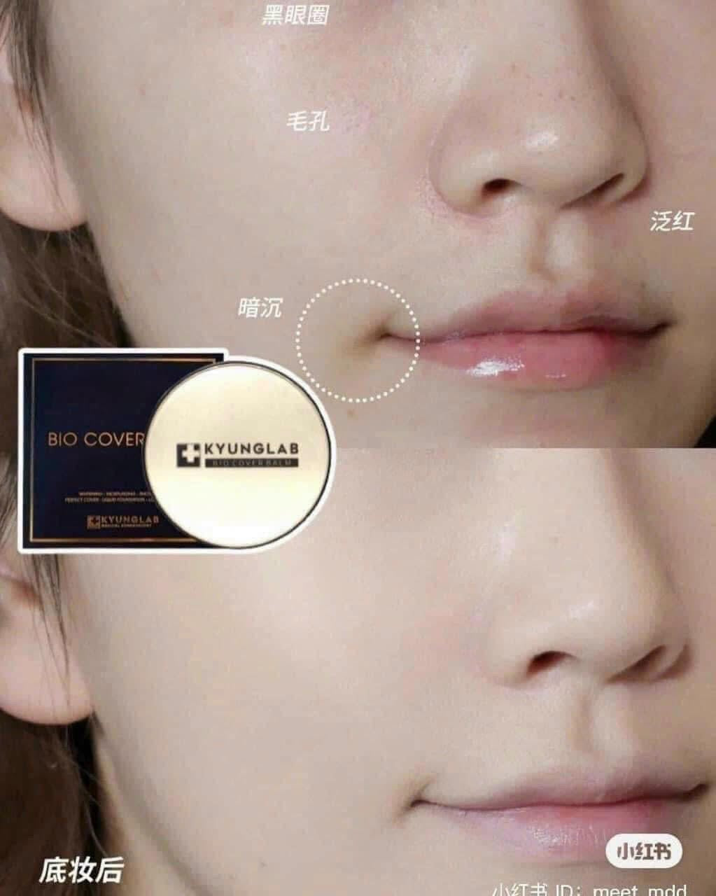 KYUNG LAB BIO COVER BALM CUSHION #21 NATURAL 15G POST TREATMENTS CUSHION