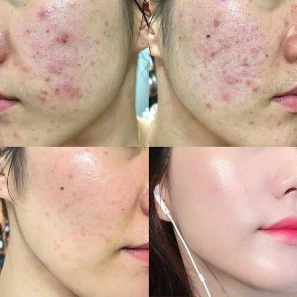 KYUNG LAB CENTELLA ASIATICA AMPOULE 50ML