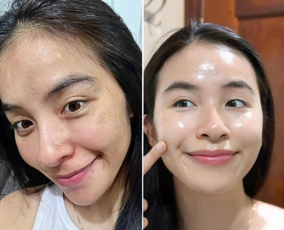 THE WHOO BICHUP ULTIMATE RECOVERY NAD POWER AMPOULE 30ML SPECIAL SET