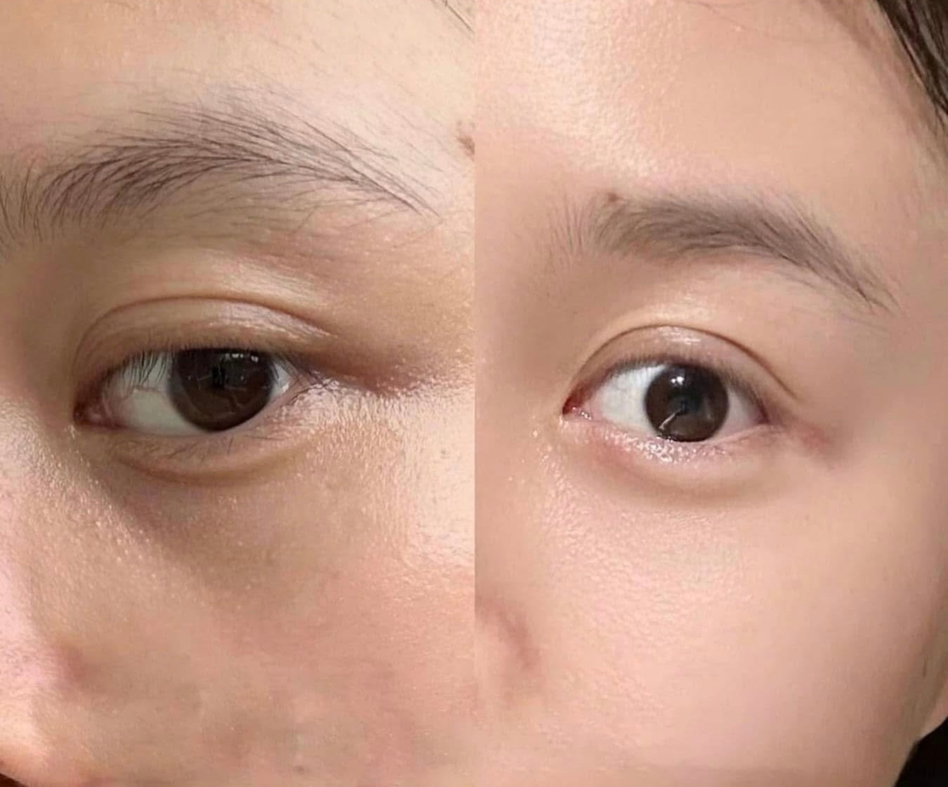 THE WHOO JINYULHYANG INTENSIVE WRINKLE CONCENTRATE SAMPLES 1ML x 120PCS