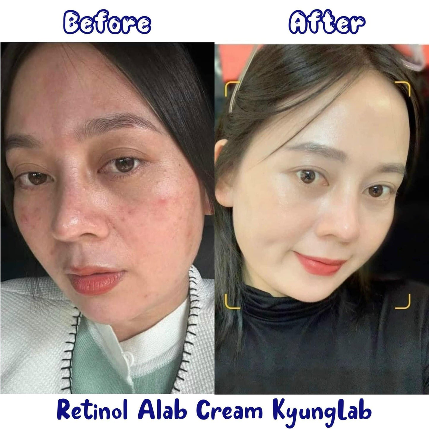 KYUNG LAB ALAB CREAM 30ML