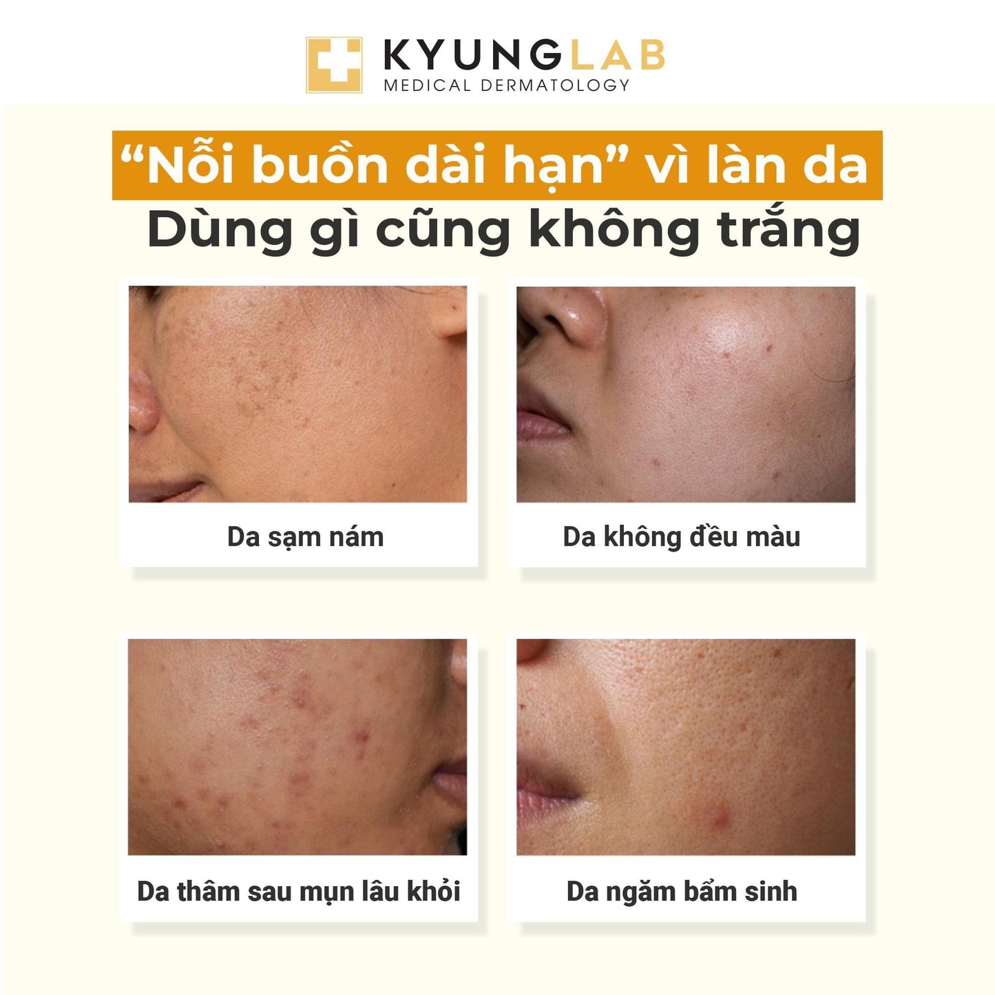 KYUNG LAB RENEWAL TRX PIGMENT CONTROL AMPOULE 50ML