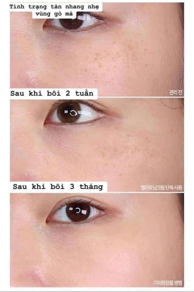 THE WHOO WHITE RADIANT MOISTURE FULL SET OF 8 ITEMS