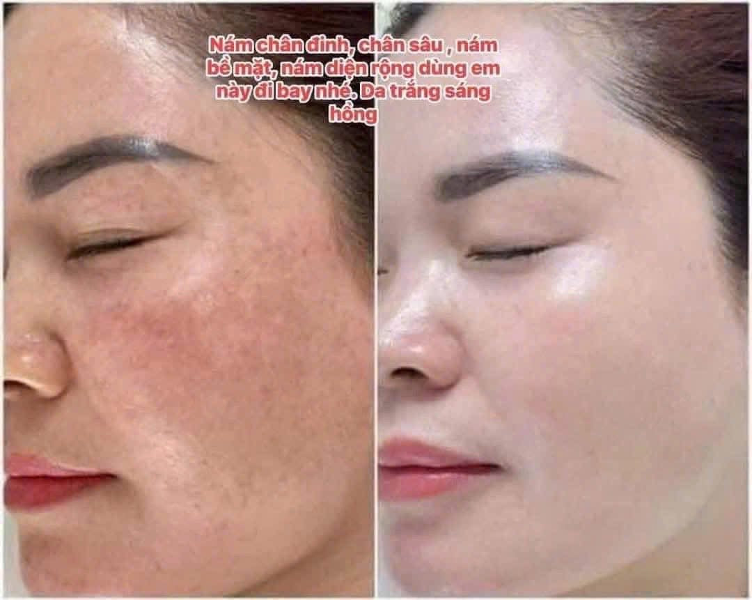 THE WHOO RADIANT WHITE ULTIMATE CORRECTOR SAMPLES 0.5ML x 50PCS