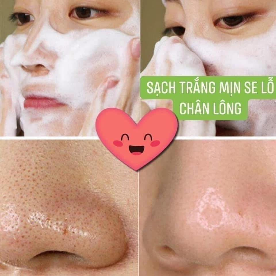 THE WHOO BRIGHTENING EXFOLIATION SET