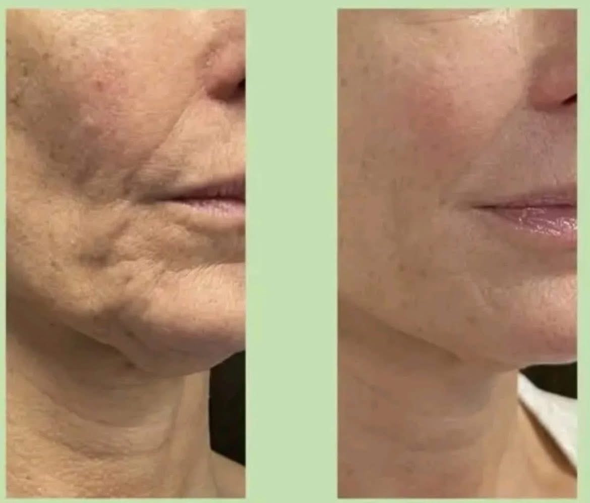 THE WHOO ULTIMATE LIFTING AMPOULE CONCENTRATE SAMPLES 1ML x 30PCS