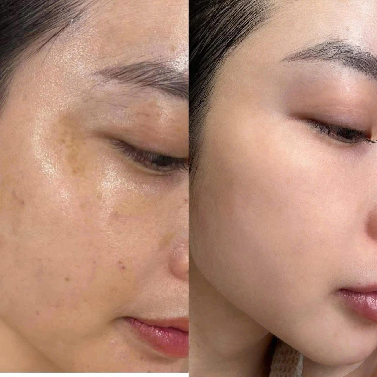 THE WHOO RADIANT WHITE ULTIMATE CORRECTOR SAMPLES 0.5ML x 50PCS