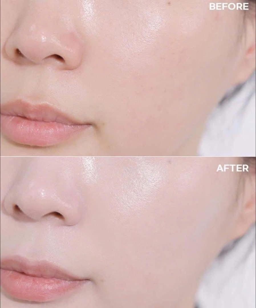 SUM37 LOSEC SUMMA GOLD REPAIR FULL SET OF 14 ITEMS