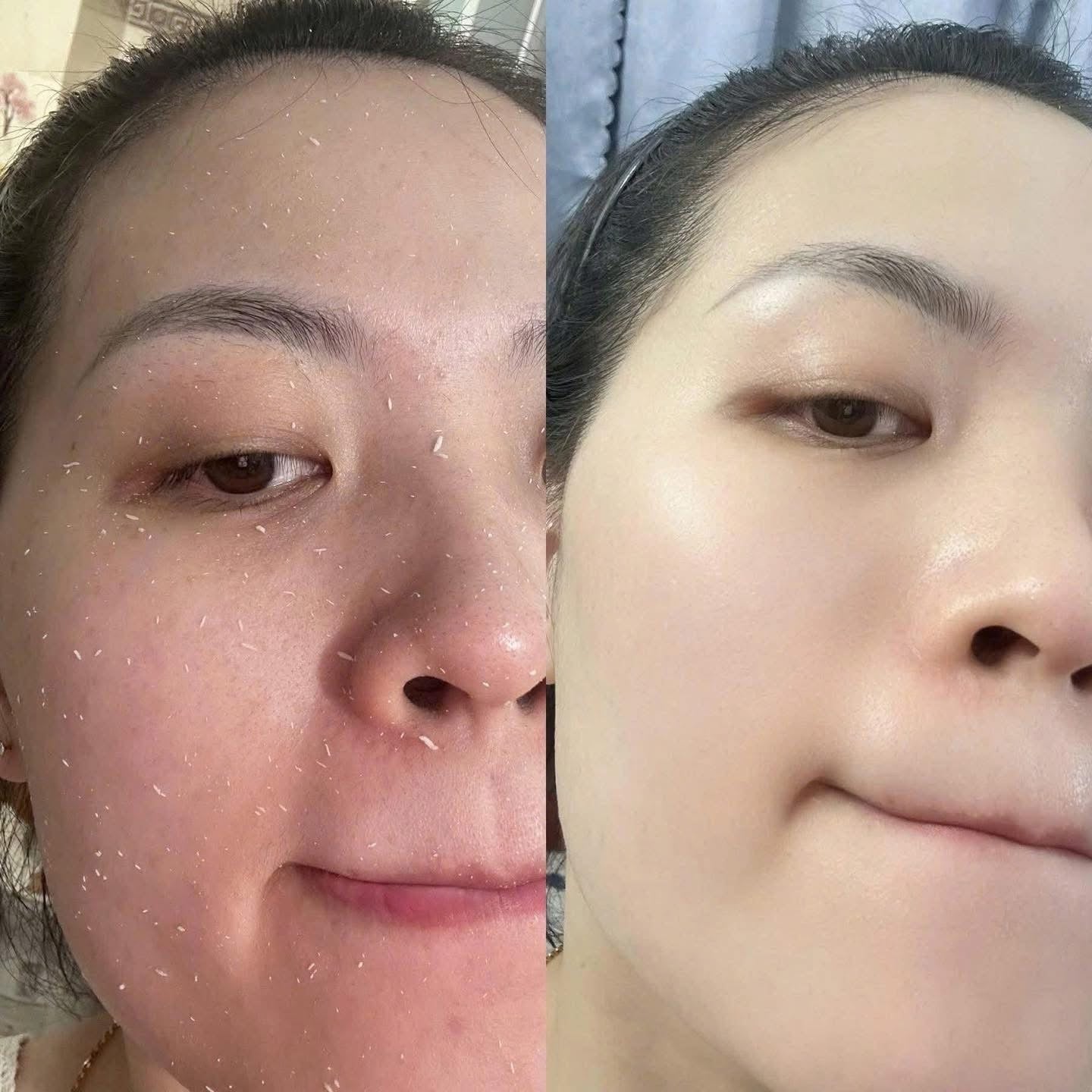 THE WHOO BRIGHTENING EXFOLIATION SET