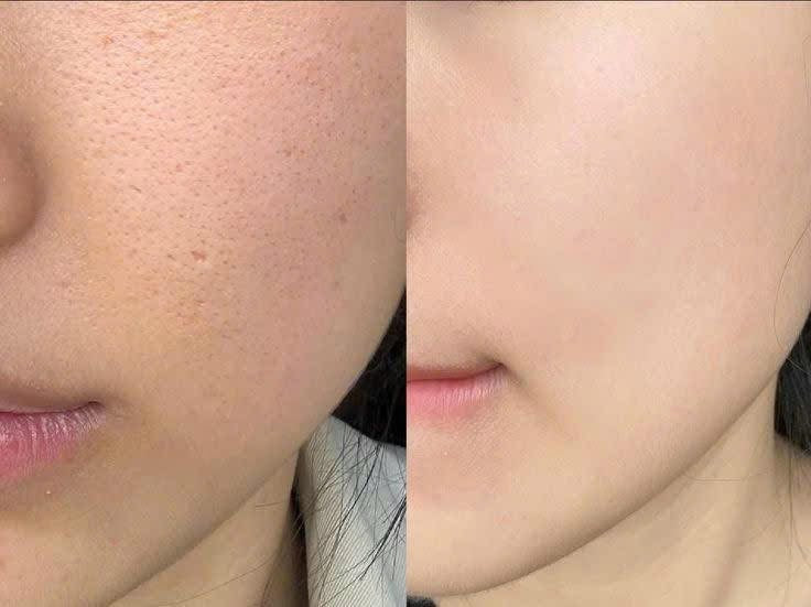 THE WHOO BICHUP 4TH GENERATION SERUM SPECIAL SET